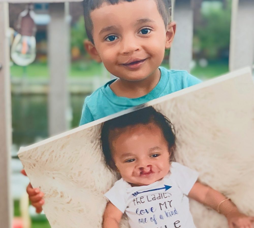 angeljayce-beforeandafter angeljayce-beforeandafter