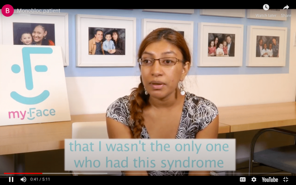 myFace - CIVA Section Image Picture of young woman with long light brown/blondish hair, wearing glasses, dangling earrings and a black and white decorative shirt. Text in image says that I wasn't the only one who had this syndrome. Screenshot of YouTube video about CIVA