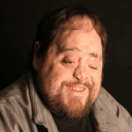 photo of a man with a facial difference and a beard smiling at the camera in front of a dark background