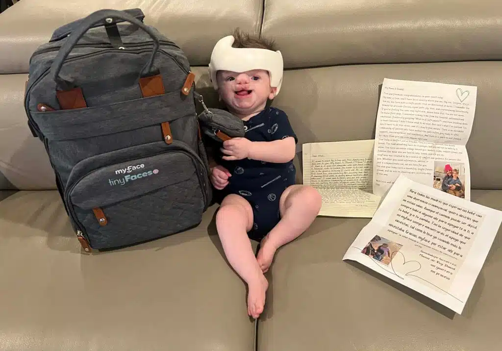Leo with tinyFaces backpack 2 baby Leo posing on the couch with tinyFaces backpack