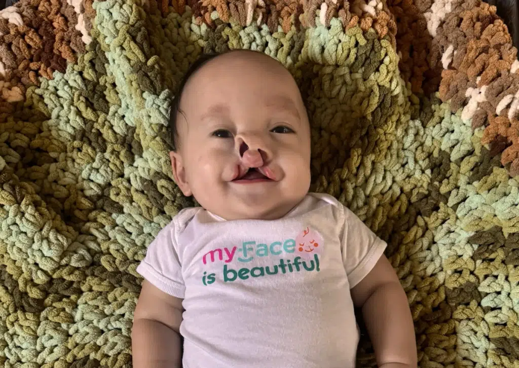 Luka Klitzing tinyFaces FY26 baby Luke wearing a 'myFace is beautiful' onesie