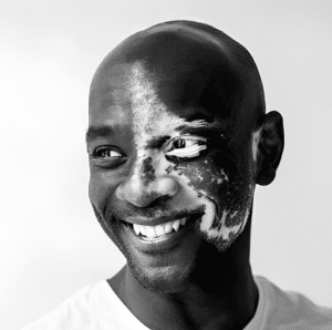james-mcleod-headshot headshot of james mcleod, "the vitiligo guy"